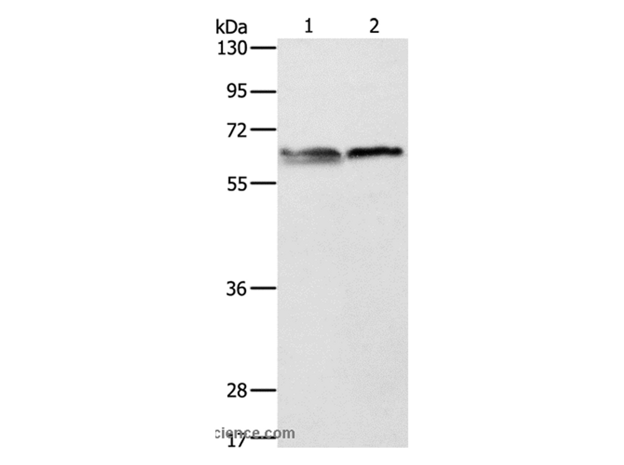 Western Blot analysis of 293T and Jurkat cell using ALAS2 Polyclonal Antibody at dilution of 1:1000