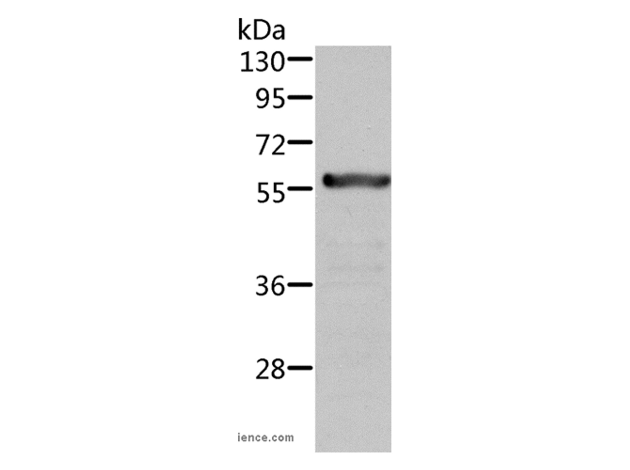 Western Blot analysis of Rat kidney tissue using ALDH6A1 Polyclonal Antibody at dilution of 1:450
