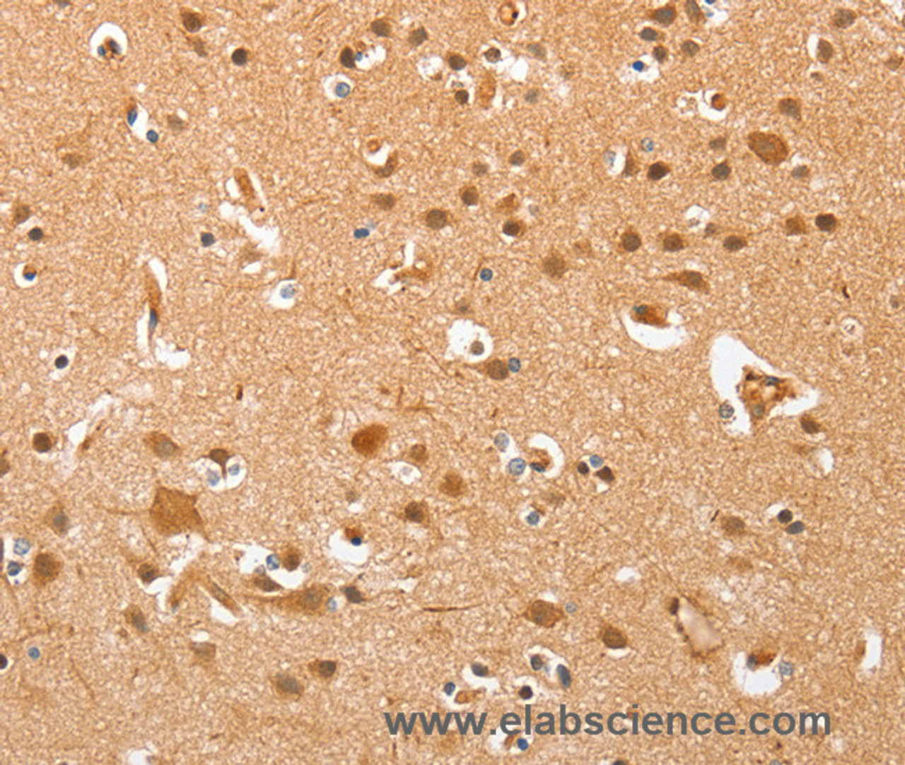 Immunohistochemistry of paraffin-embedded Human brain  using AHSG Polyclonal Antibody at dilution of 1:60