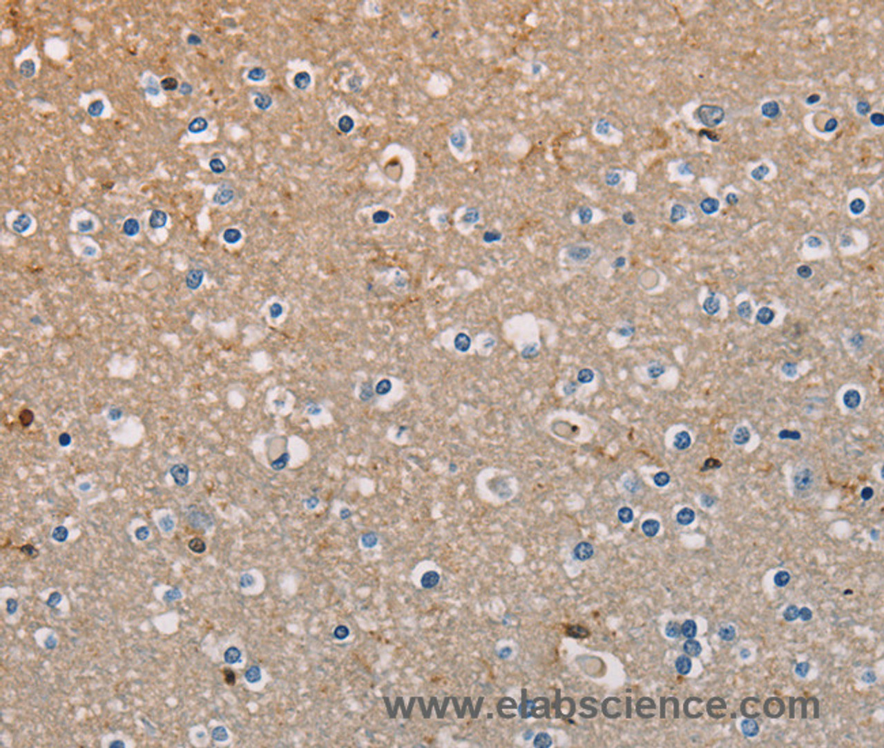 Immunohistochemistry of paraffin-embedded Human brain tissue using AMBRA1 Polyclonal Antibody at dilution 1:50