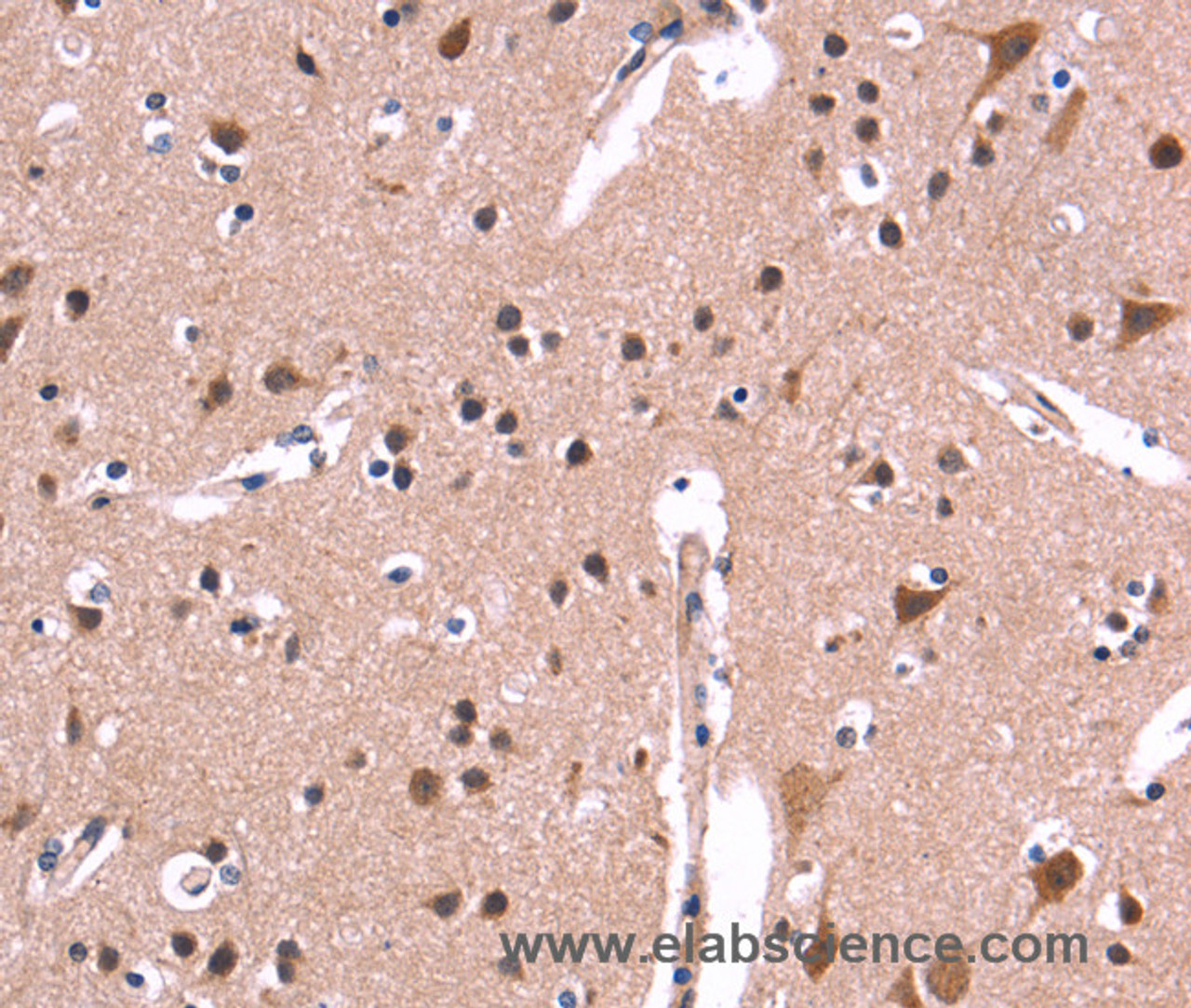 Immunohistochemistry of paraffin-embedded Human brain  tissue using ARC Polyclonal Antibody at dilution 1:50