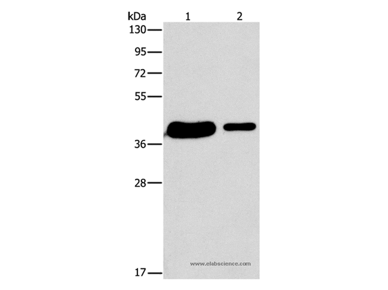 Western Blot analysis of 293T and A431 cell using SAE1 Polyclonal Antibody at dilution of 1:400