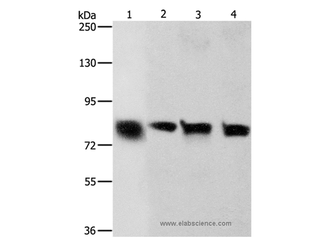 Western Blot analysis of Hela and A549 cell, Human liver cancer tissue and HT-29 cell using K-Cadherin Polyclonal Antibody at dilution of 1:500