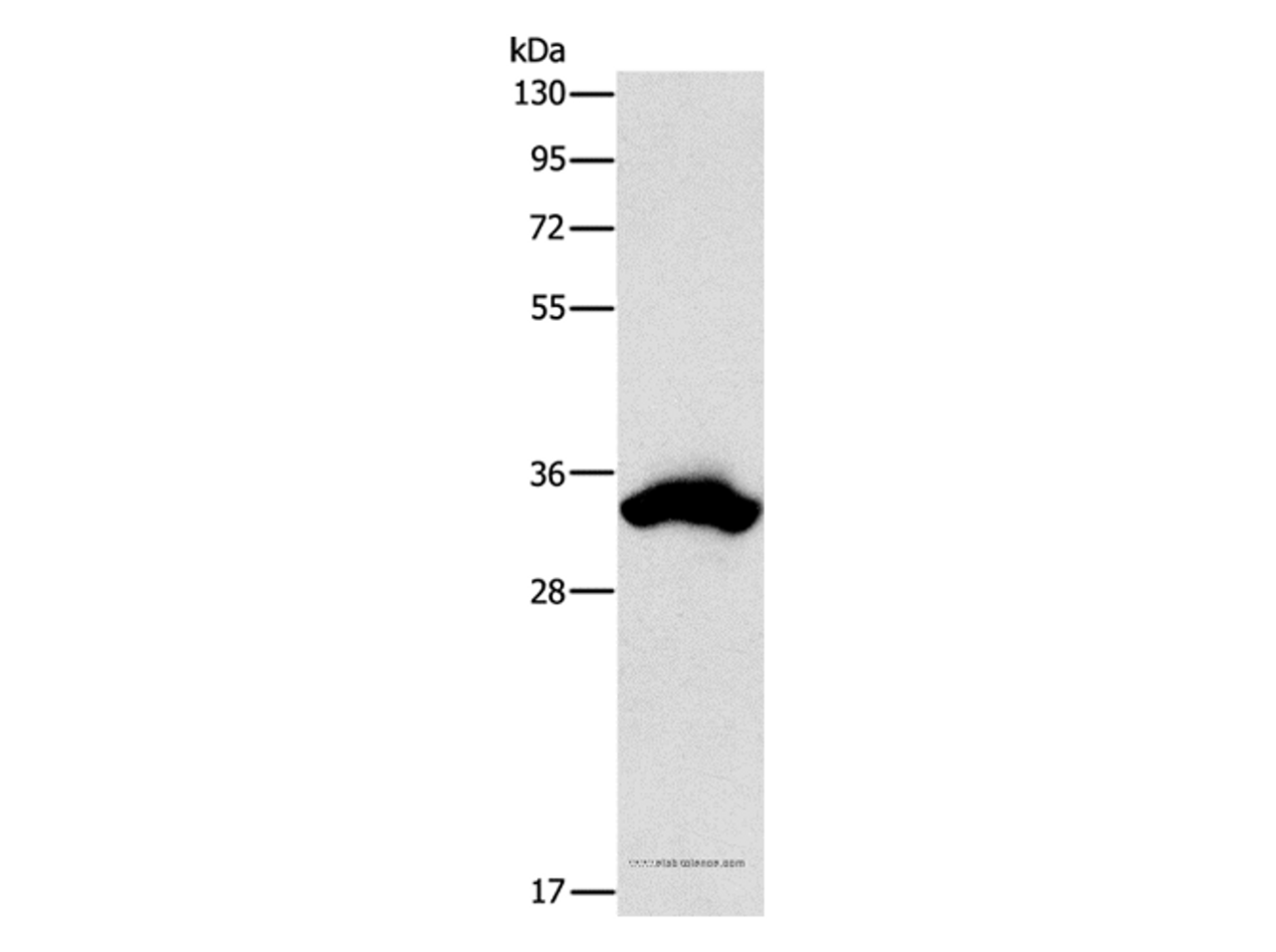 Western Blot analysis of 293T cell using CDCA8 Polyclonal Antibody at dilution of 1:900