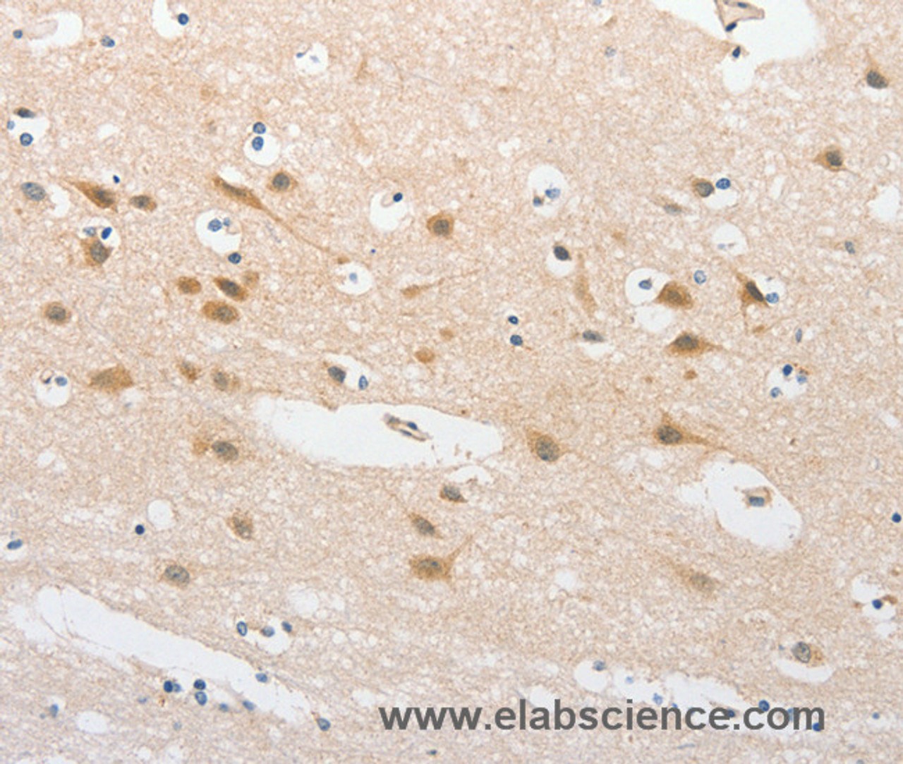 Immunohistochemistry of paraffin-embedded Human brain  tissue using TLR5 Polyclonal Antibody at dilution 1:30