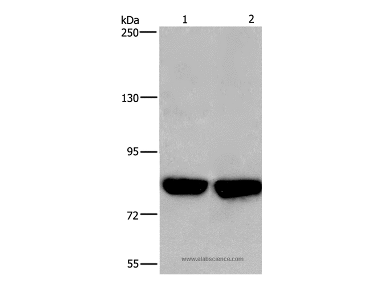 Western Blot analysis of Hela and PC3 cell using PFKP Polyclonal Antibody at dilution of 1:500