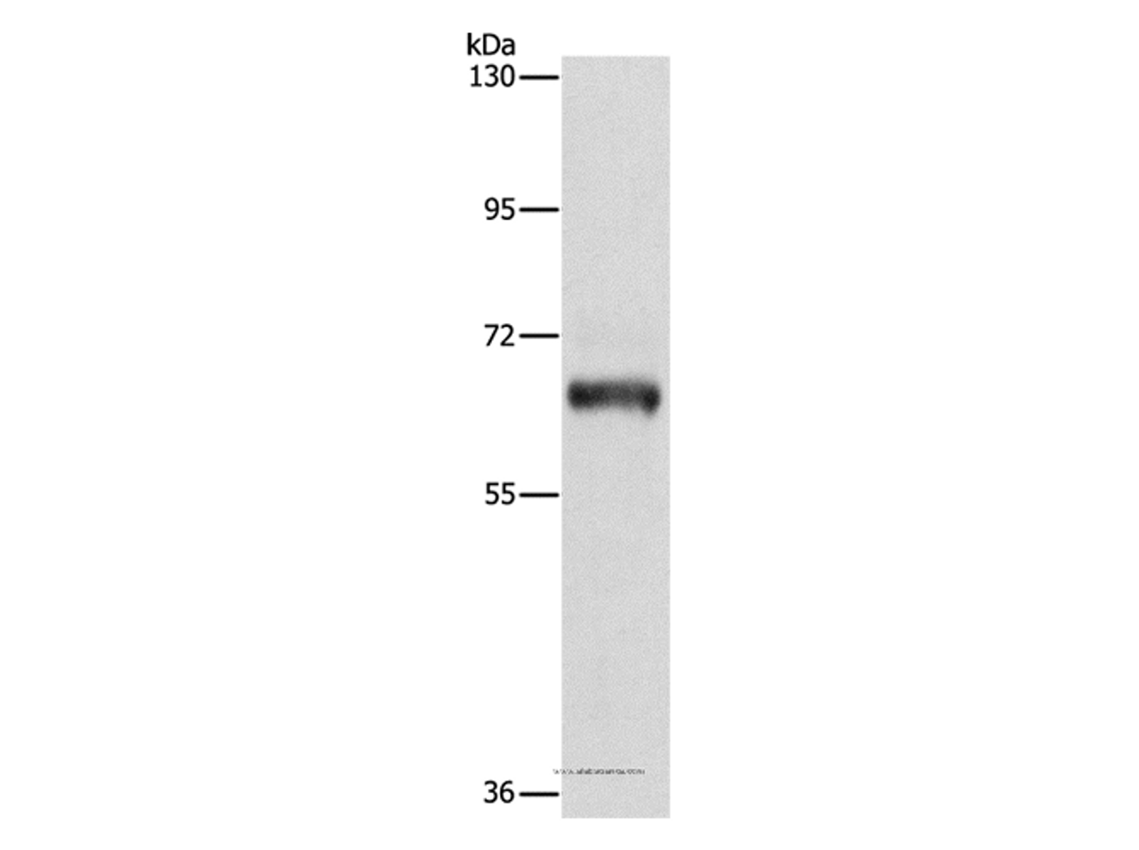 Western Blot analysis of Lovo cell using KLC1 Polyclonal Antibody at dilution of 1:500