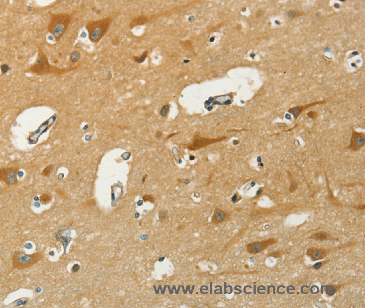 Immunohistochemistry of paraffin-embedded Human brain  using KLC1 Polyclonal Antibody at dilution of 1:40