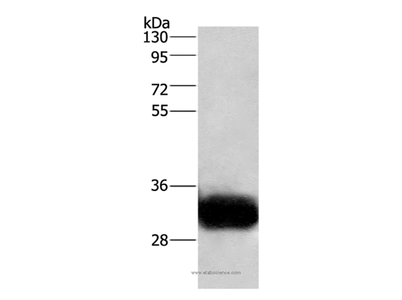 Western Blot analysis of Human fetal brain tissue using GPM6A Polyclonal Antibody at dilution of 1:950