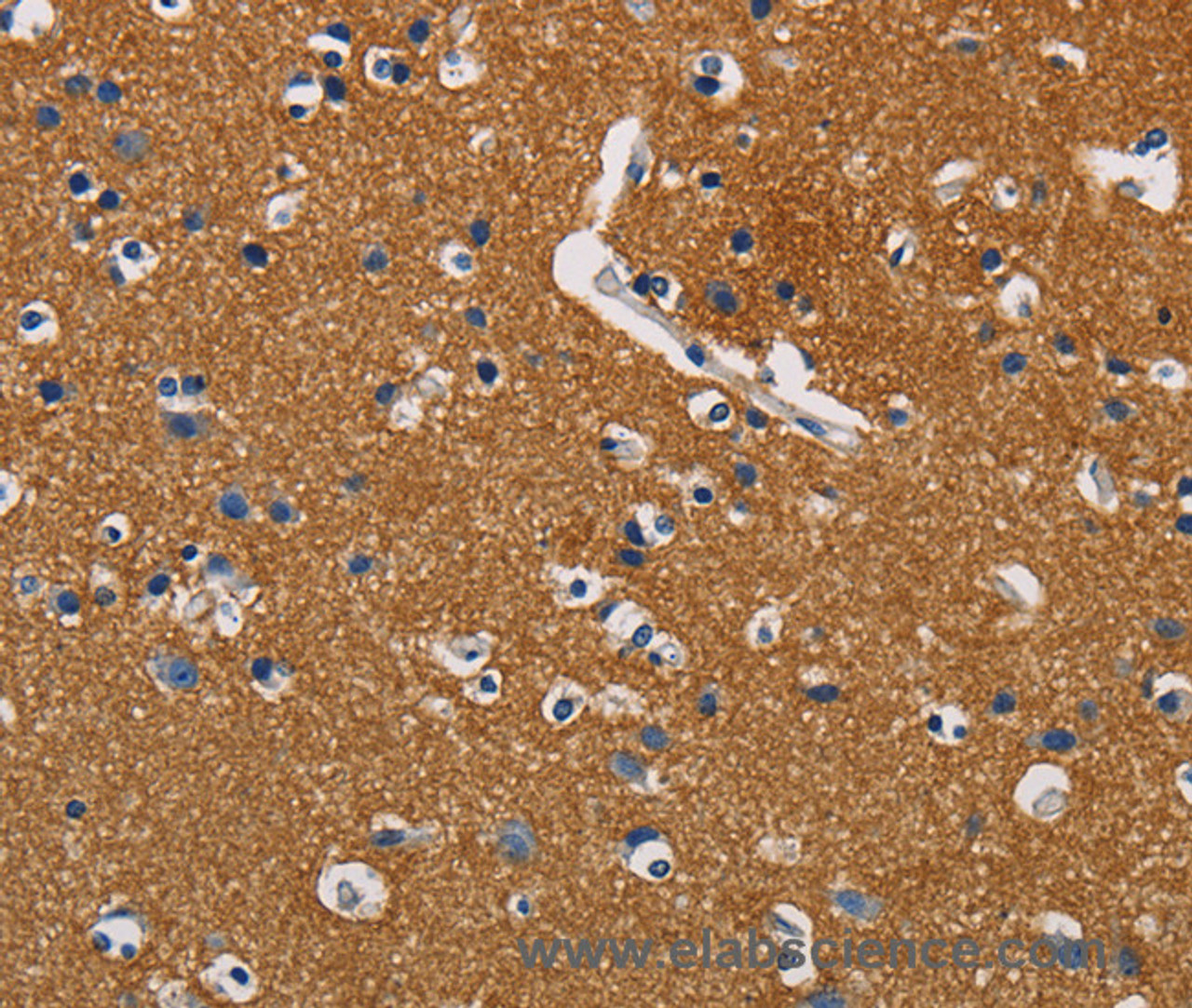 Immunohistochemistry of paraffin-embedded Human brain using GPM6A Polyclonal Antibody at dilution of 1:40