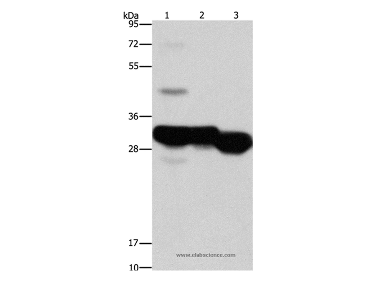 Western Blot analysis of Mouse liver and kidney tissue, Human fetal liver tissue using KHK Polyclonal Antibody at dilution of 1:1250