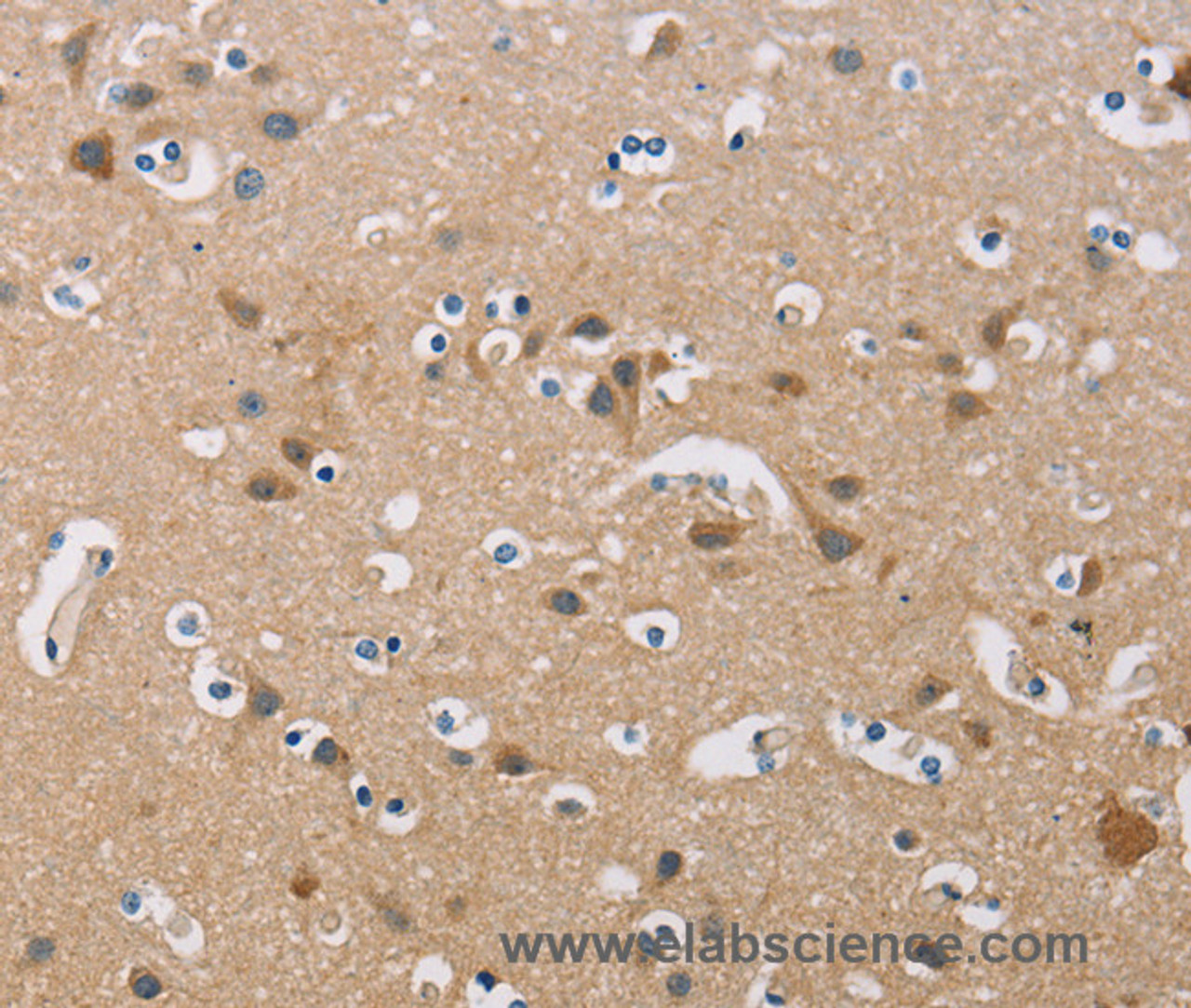 Immunohistochemistry of paraffin-embedded Human brain  using FXYD1 Polyclonal Antibody at dilution of 1:60