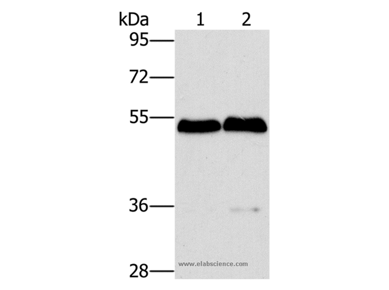 Western Blot analysis of Mouse brain and liver tissue using SPHK2 Polyclonal Antibody at dilution of 1:200