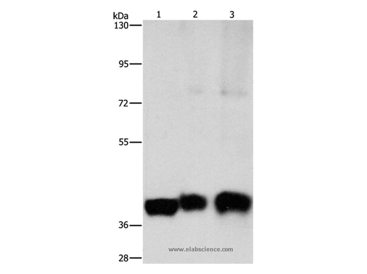Western Blot analysis of Human lung cancer tissue, Human fetal brain and fetal lung tissue using ASAH1 Polyclonal Antibody at dilution of 1:850