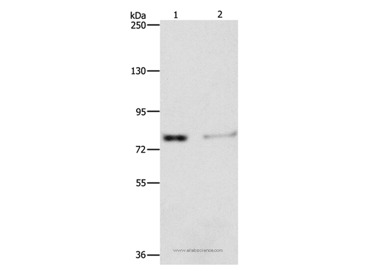 Western Blot analysis of Human fetal kidney tissue and 293T cell using ASAH2 Polyclonal Antibody at dilution of 1:240