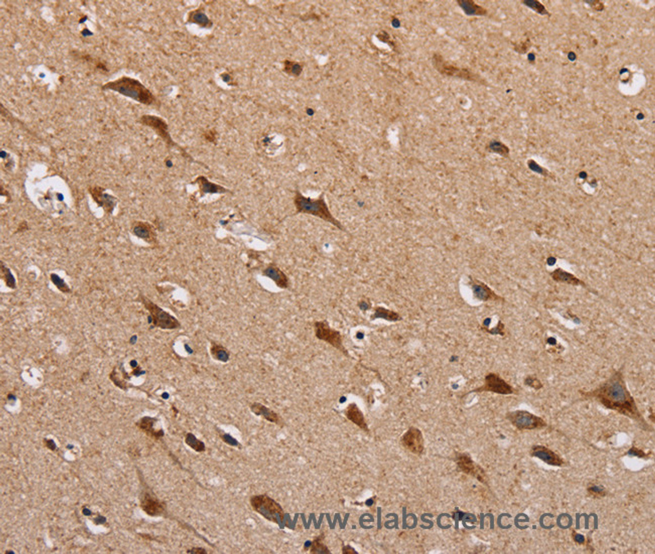 Immunohistochemistry of paraffin-embedded Human brain  using HTR3C Polyclonal Antibody at dilution of 1:30