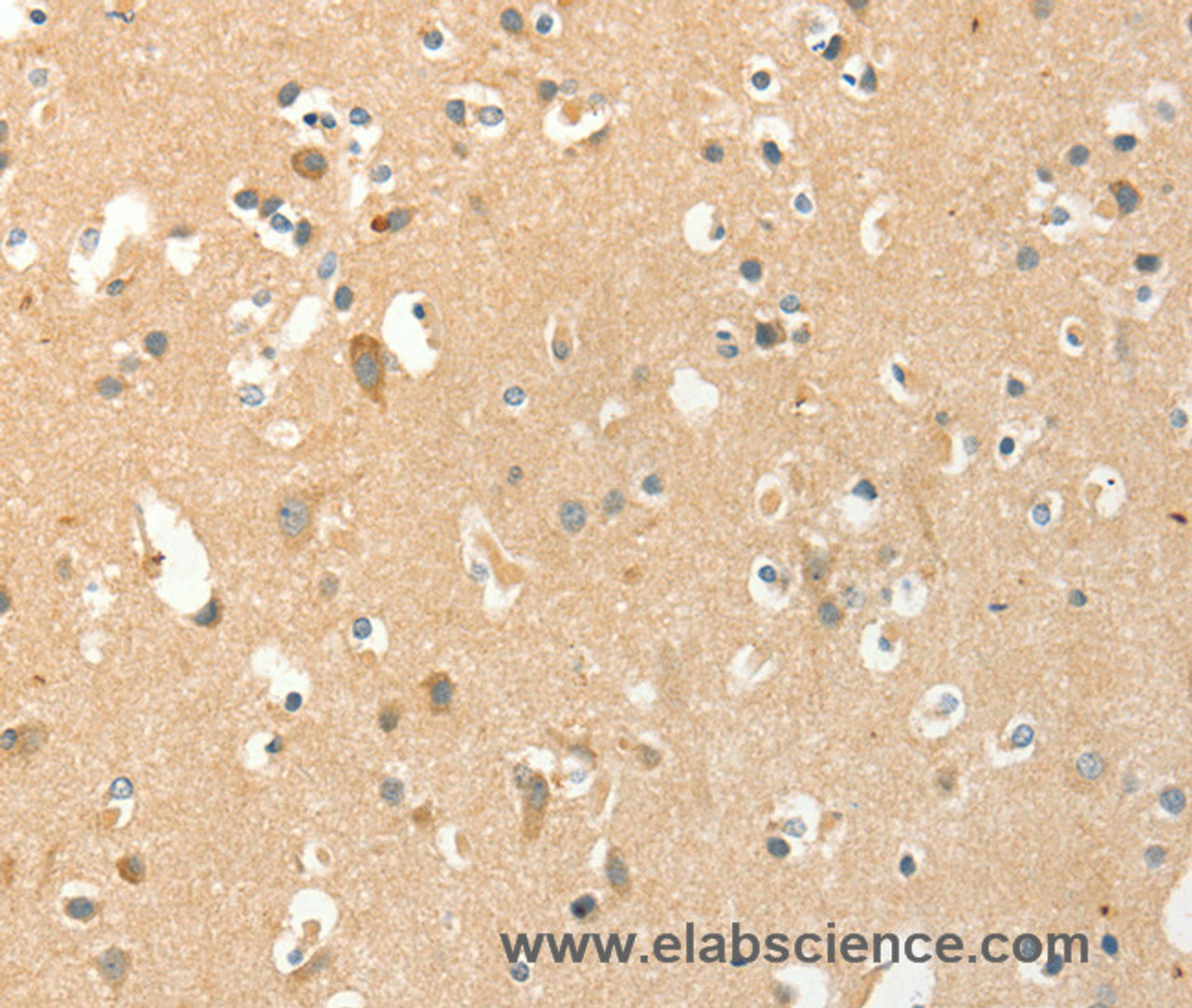 Immunohistochemistry of paraffin-embedded Human brain  tissue using AANAT Polyclonal Antibody at dilution 1:40