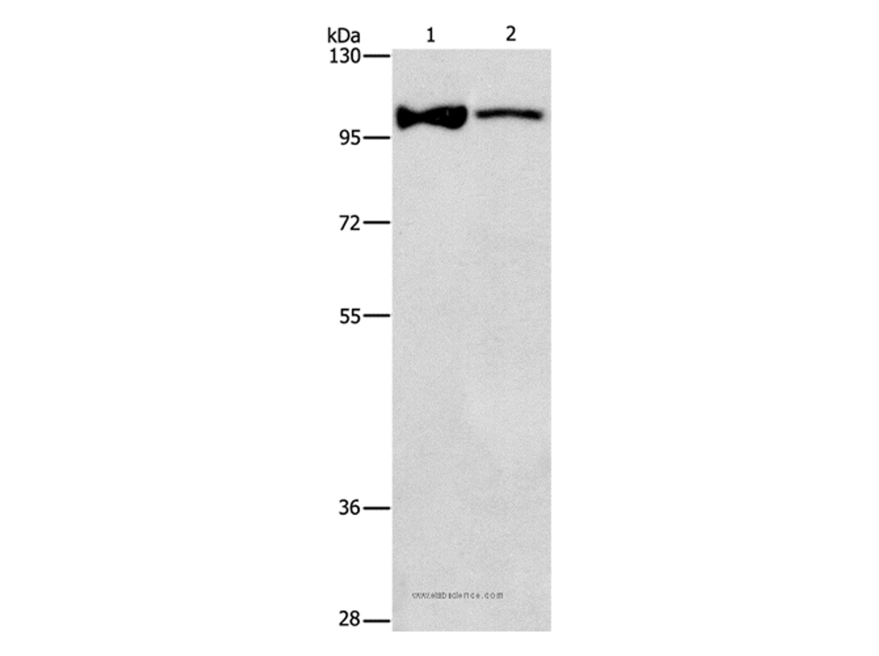 Western Blot analysis of Lovo cell and Human fetal brain tissue using ADCY3 Polyclonal Antibody at dilution of 1:312.5