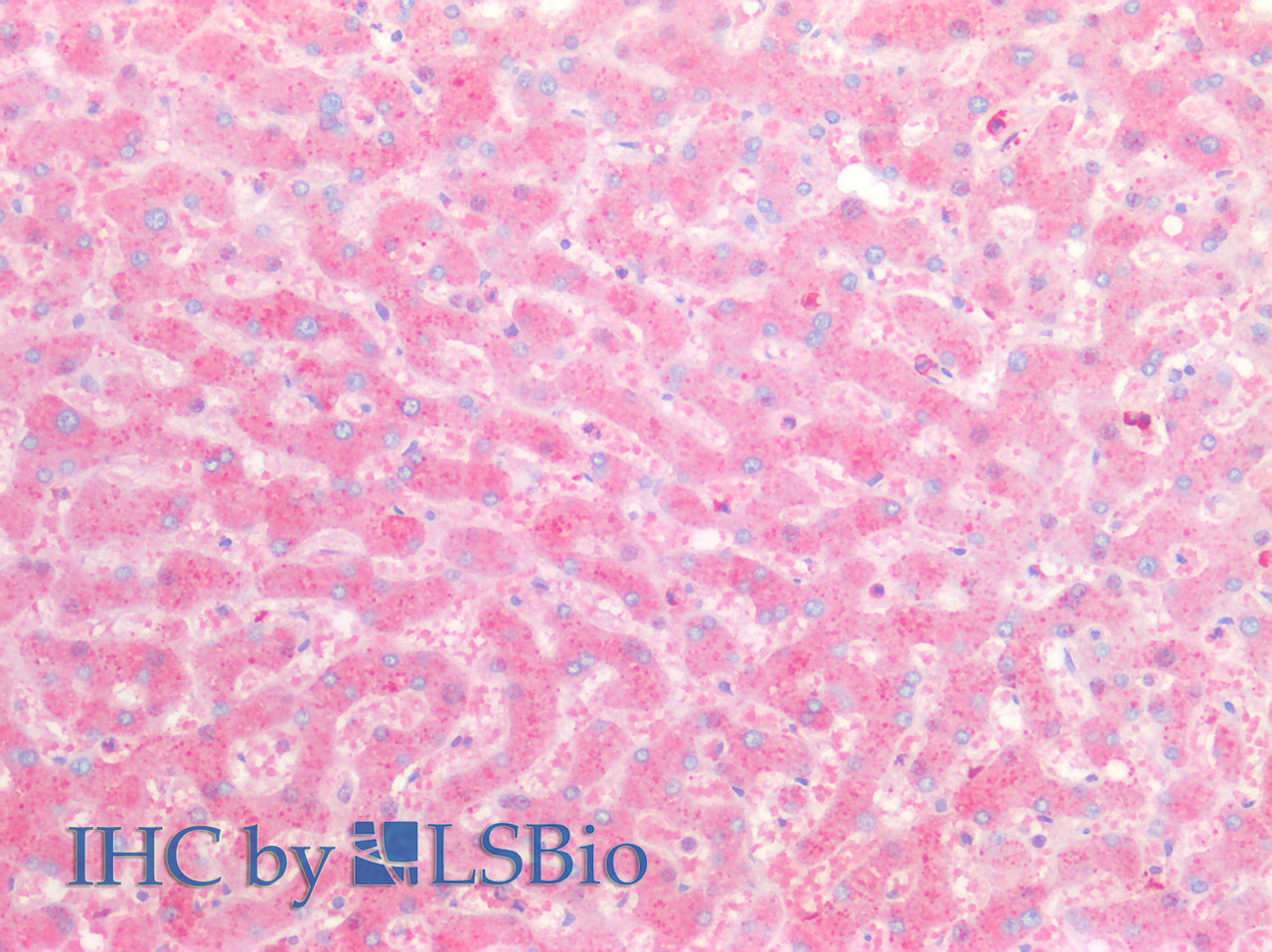 Immunohistochemistry of paraffin-embedded Human liver tissue using ORM2 Polyclonal Antibody at dilution of 1:100(Elabscience® Product Detected by Lifespan).