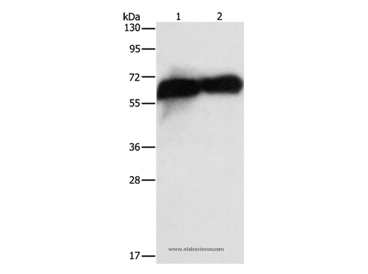 Western Blot analysis of HepG2 cell and Human placenta tissue using Placental Alkaline Phosphatase Polyclonal Antibody at dilution of 1:1450