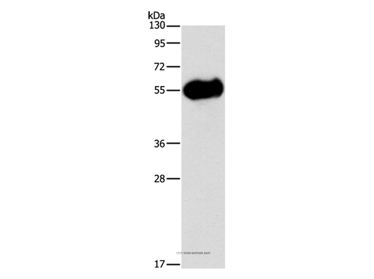 Western Blot analysis of Mouse pancreas tissue using AMY2A Polyclonal Antibody at dilution of 1:1400