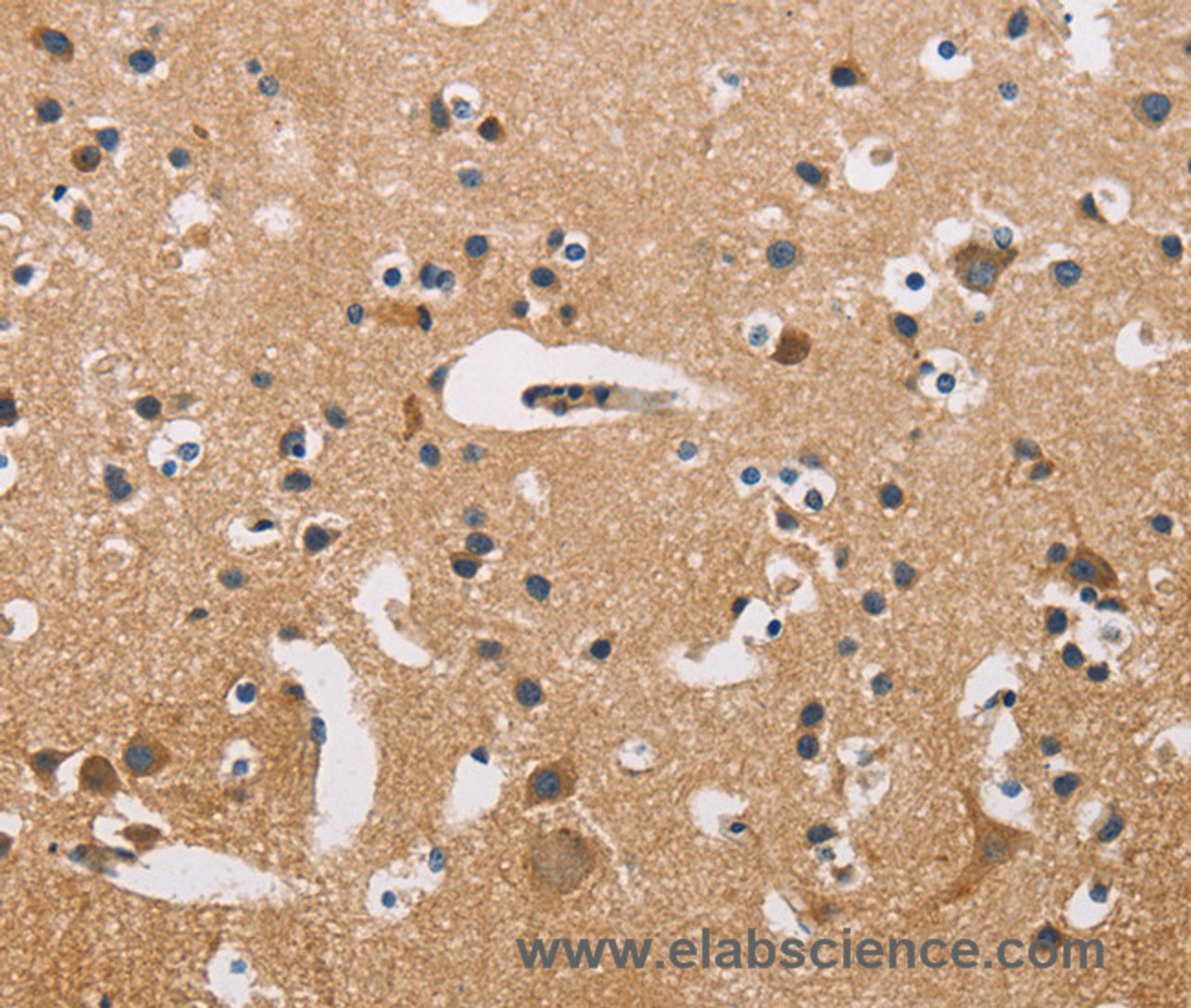 Immunohistochemistry of paraffin-embedded Human brain tissue using ATP2C1 Polyclonal Antibody at dilution 1:50