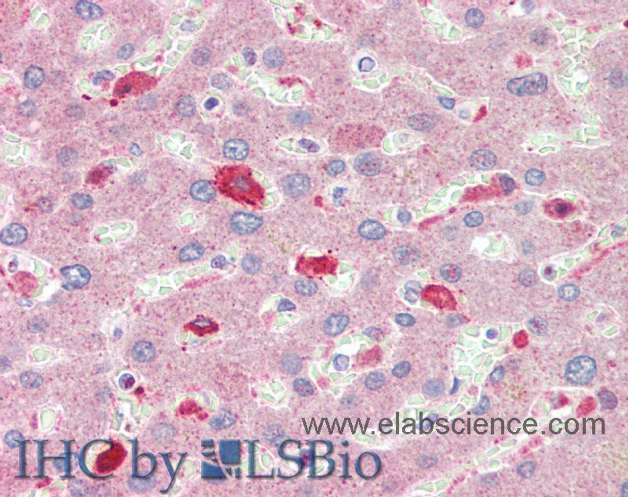 Immunohistochemistry of paraffin-embedded Liver tissue using BCAT1 Polyclonal Antibody at dilution of 1:100(Elabscience® Product Detected by Lifespan).