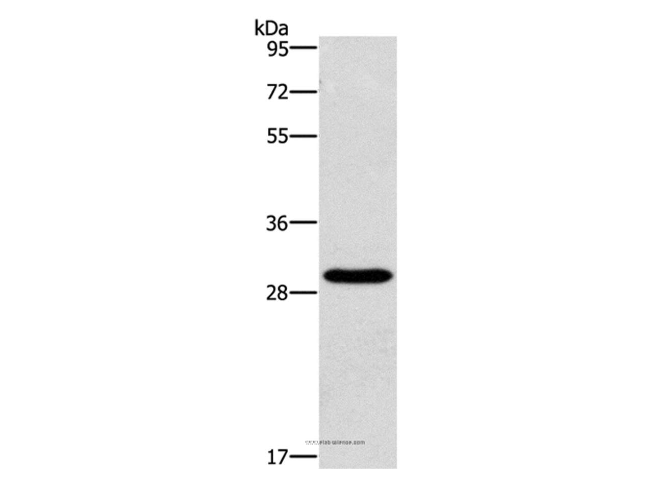 Western Blot analysis of Hela cell using BCL10 Polyclonal Antibody at dilution of 1:950
