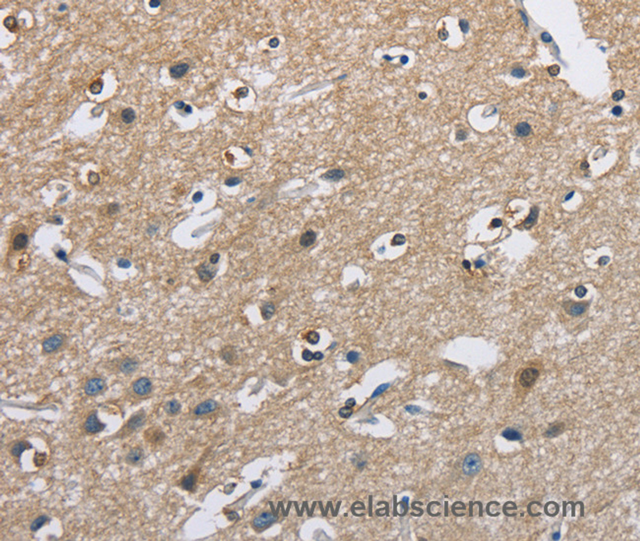 Immunohistochemistry of paraffin-embedded Human brain  using CAB39L Polyclonal Antibody at dilution of 1:40
