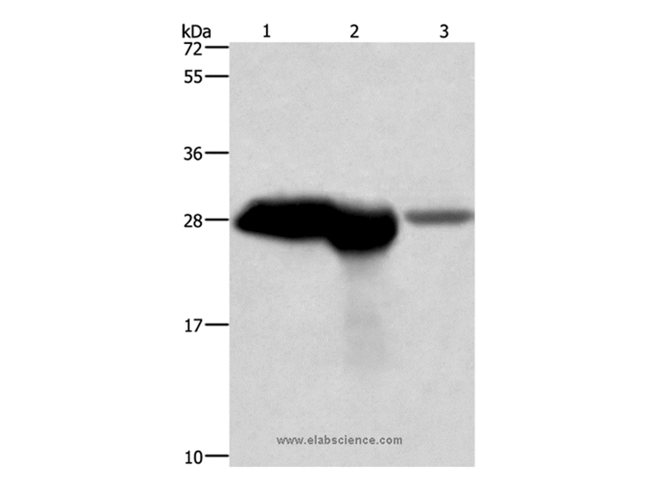 Western Blot analysis of Mouse brain and kidney tissue, Human fetal brain tissue using CALB1 Polyclonal Antibody at dilution of 1:750