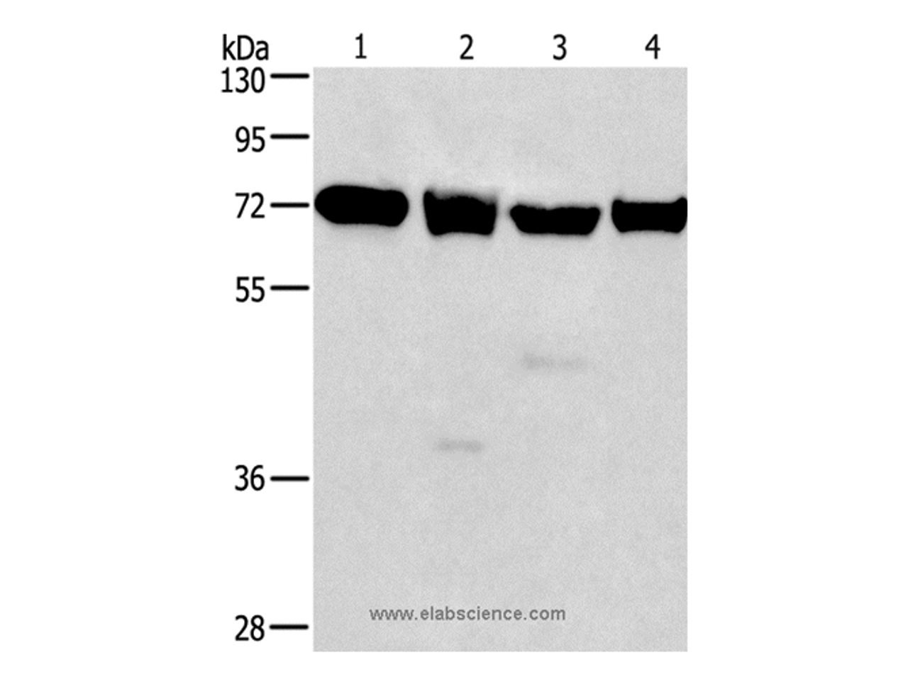 Western Blot analysis of 231, 293T, Raji and hela cell using IL2RB Polyclonal Antibody at dilution of 1:325