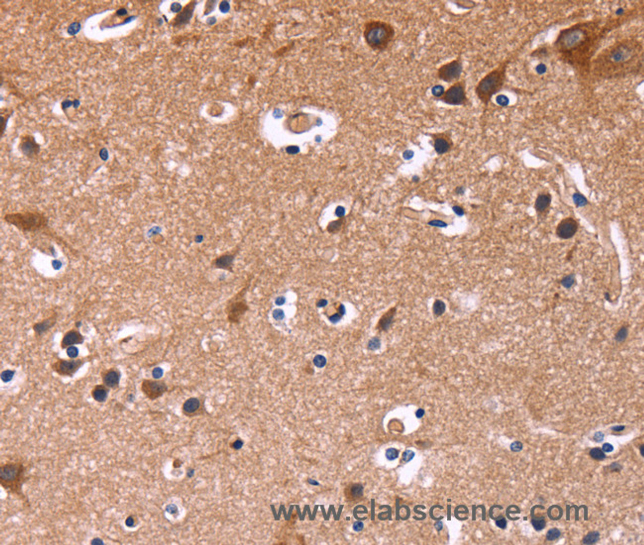 Immunohistochemistry of paraffin-embedded Human brain  tissue using SIGLEC5 Polyclonal Antibody at dilution 1:30