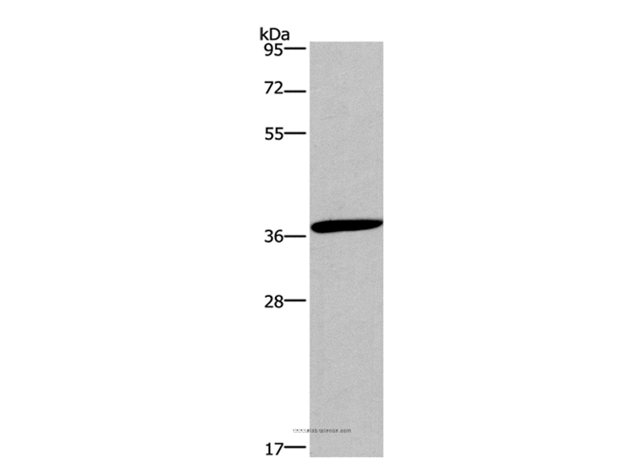 Western Blot analysis of Jurkat cell using CD1A Polyclonal Antibody at dilution of 1:550