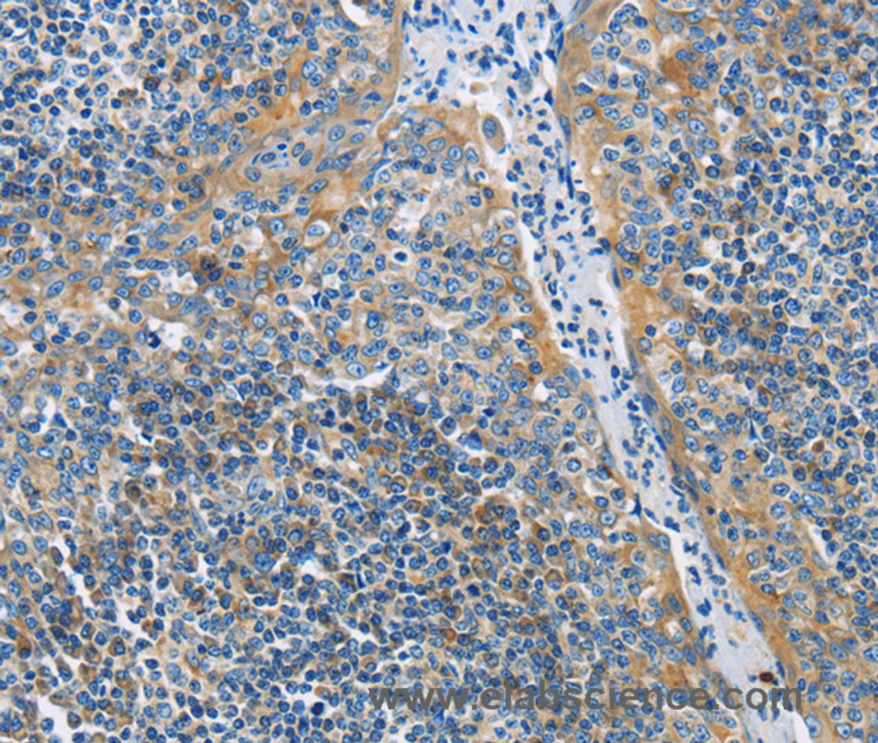 Immunohistochemistry of paraffin-embedded Human tonsil tissue using CD272 Polyclonal Antibody at dilution 1:30