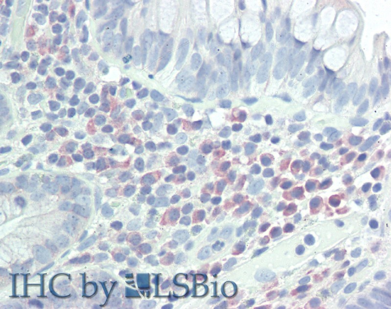 Immunohistochemistry of paraffin-embedded Small Intestine tissue using CD272 Polyclonal Antibody at dilution of 1:50 (Elabscience® Product Detected by Lifespan).