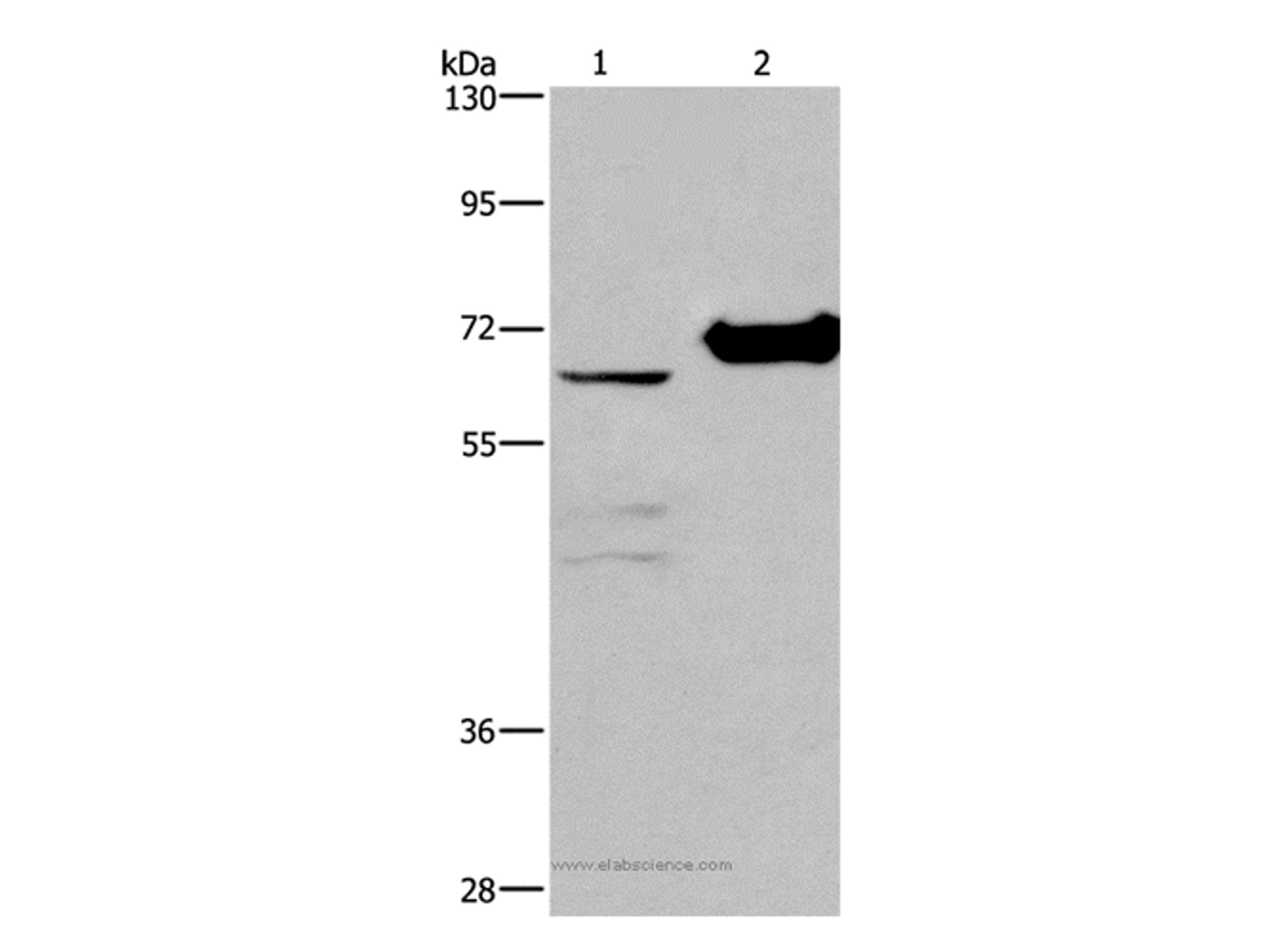 Western Blot analysis of 231 cell and Mouse kidney tissue using CHDH Polyclonal Antibody at dilution of 1:400