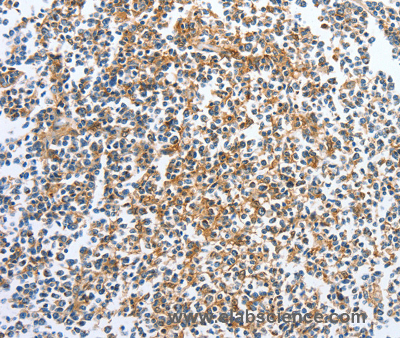 Immunohistochemistry of paraffin-embedded Human tonsil tissue using CKAP2 Polyclonal Antibody at dilution 1:70