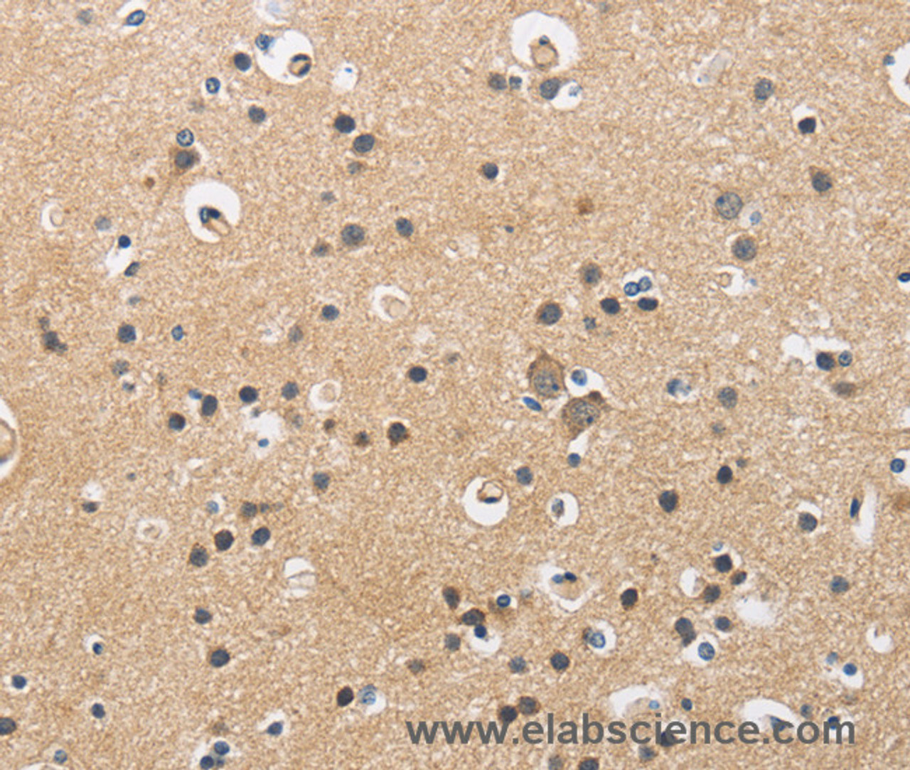 Immunohistochemistry of paraffin-embedded Human brain  using CKMT2 Polyclonal Antibody at dilution of 1:60