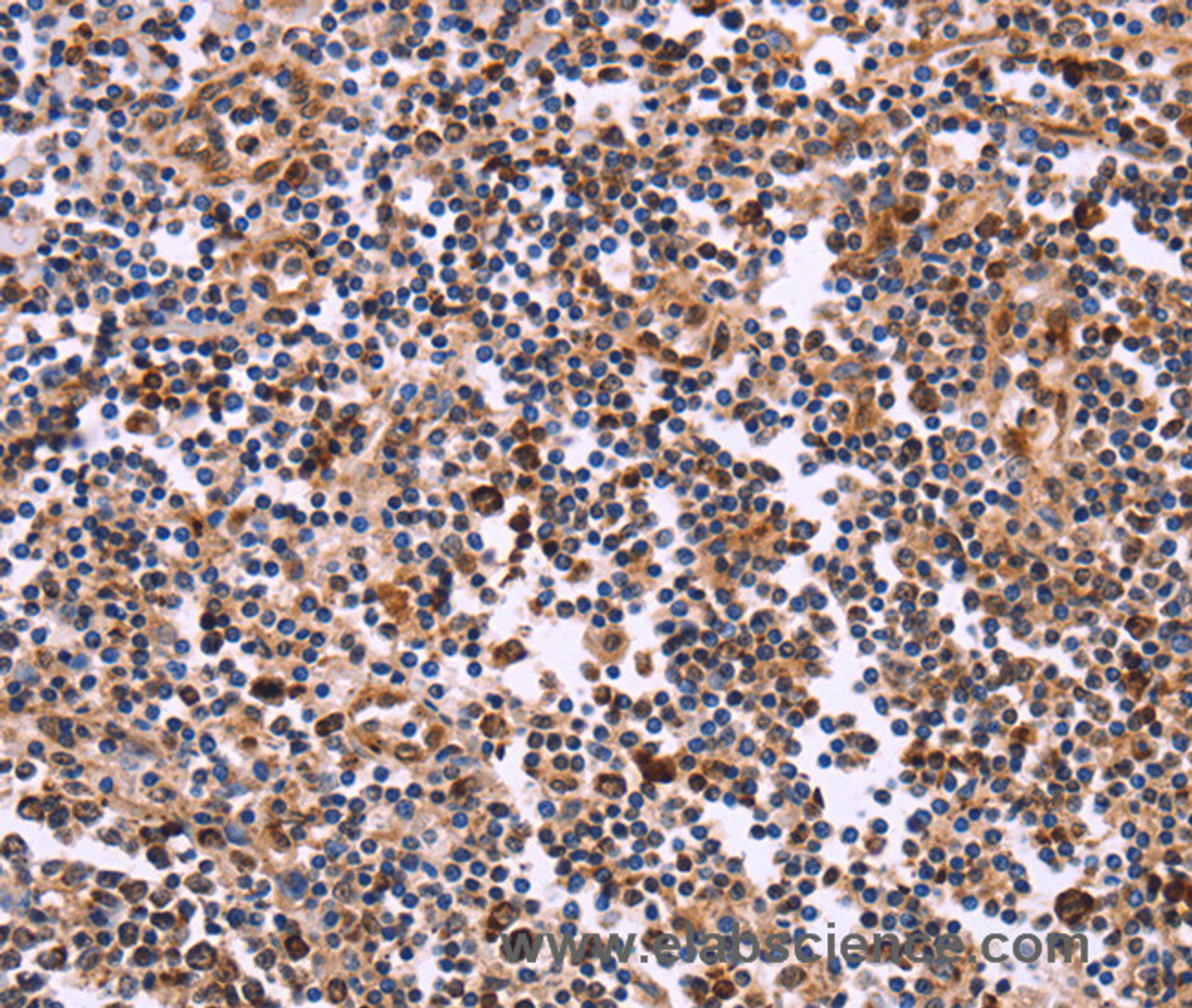 Immunohistochemistry of paraffin-embedded Human tonsil tissue using CLUAP1 Polyclonal Antibody at dilution 1:50