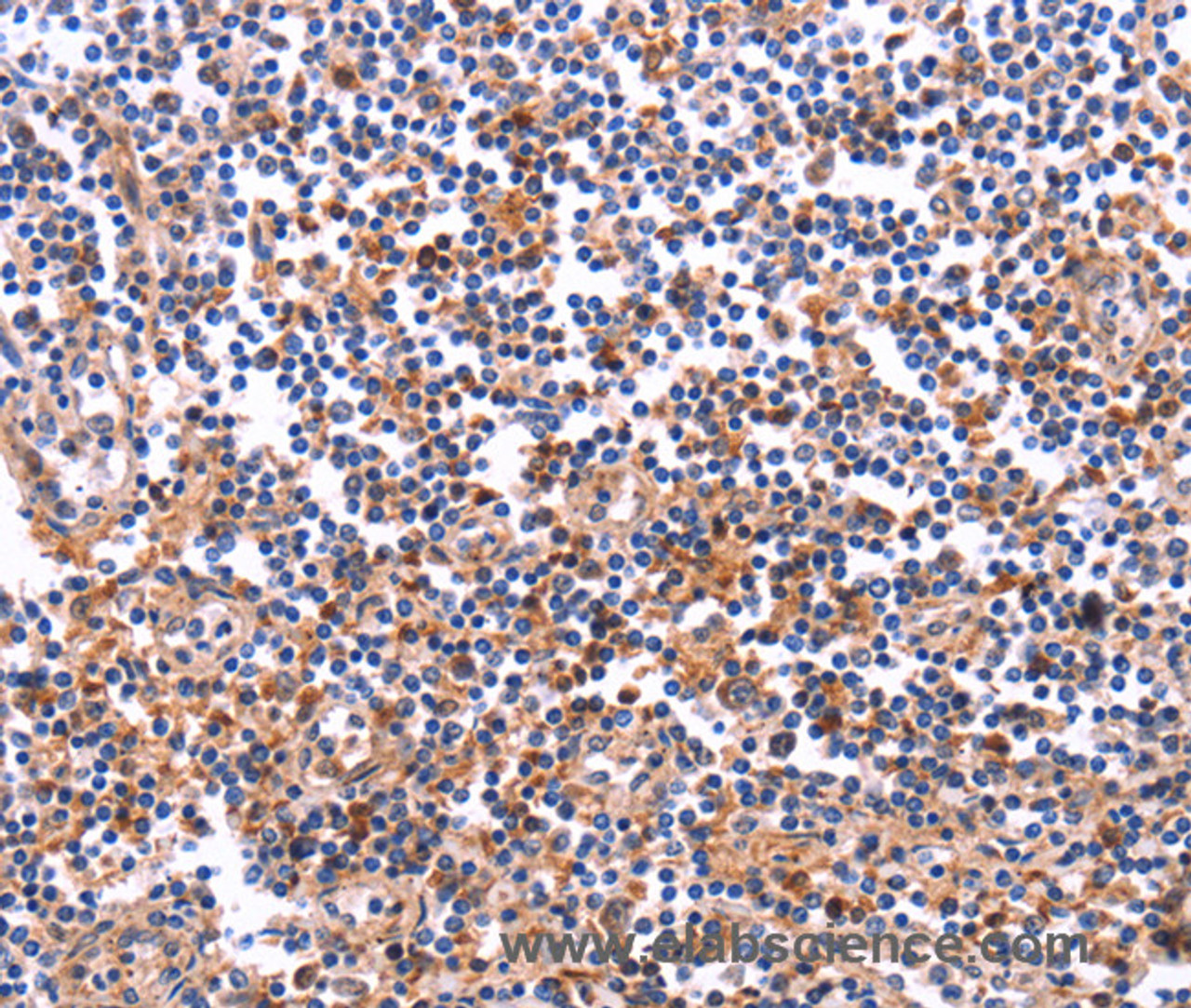 Immunohistochemistry of paraffin-embedded Human tonsil tissue using COL20A1 Polyclonal Antibody at dilution 1:40