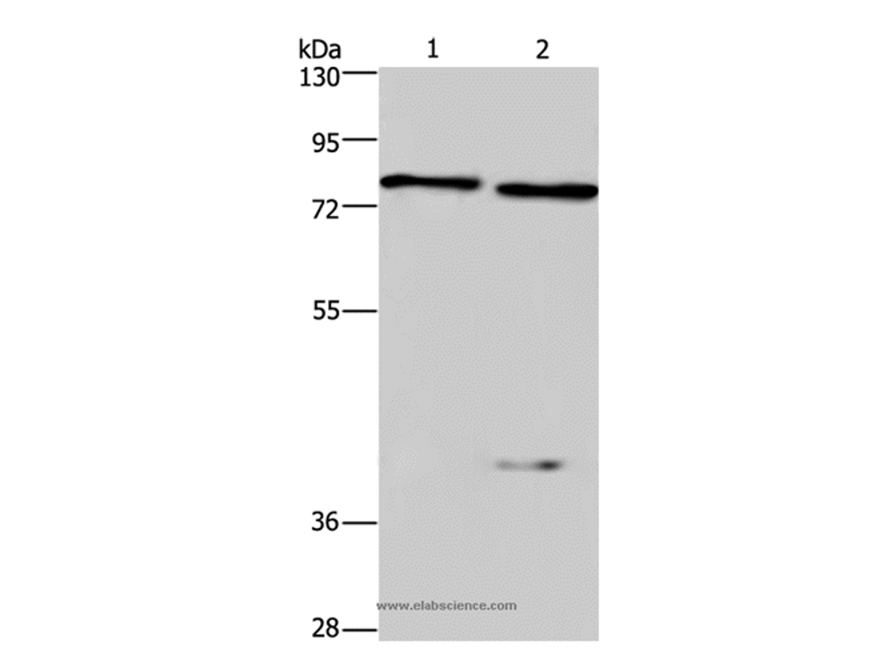 Western Blot analysis of Mouse brain and kindey tissue using COL4A3BP Polyclonal Antibody at dilution of 1:300