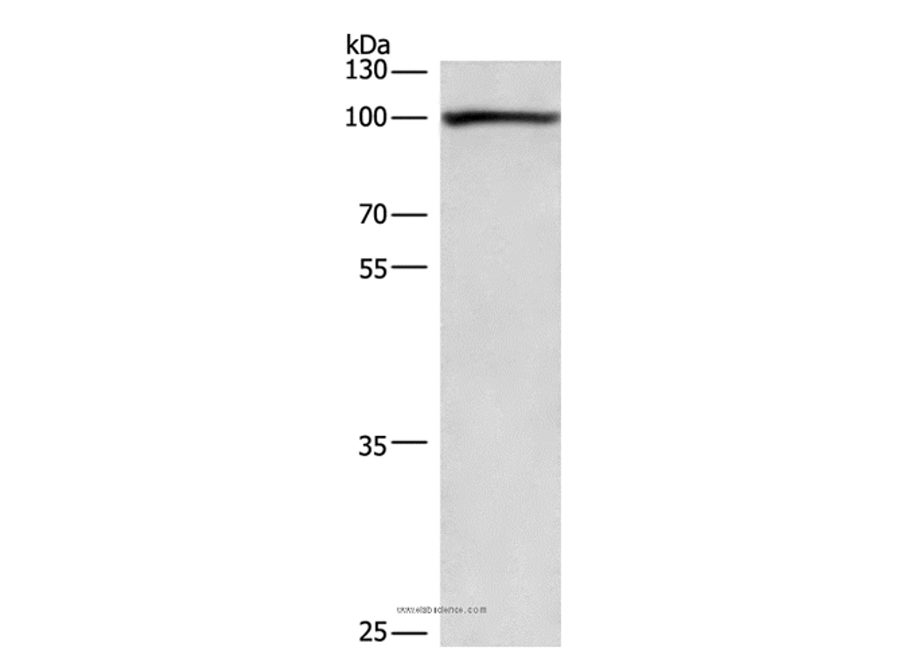 Western Blot analysis of 293T cell using cPLA2 Polyclonal Antibody at dilution of 1:750
