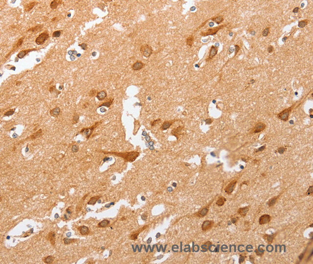 Immunohistochemistry of paraffin-embedded Human brain  using cPLA2 Polyclonal Antibody at dilution of 1:50