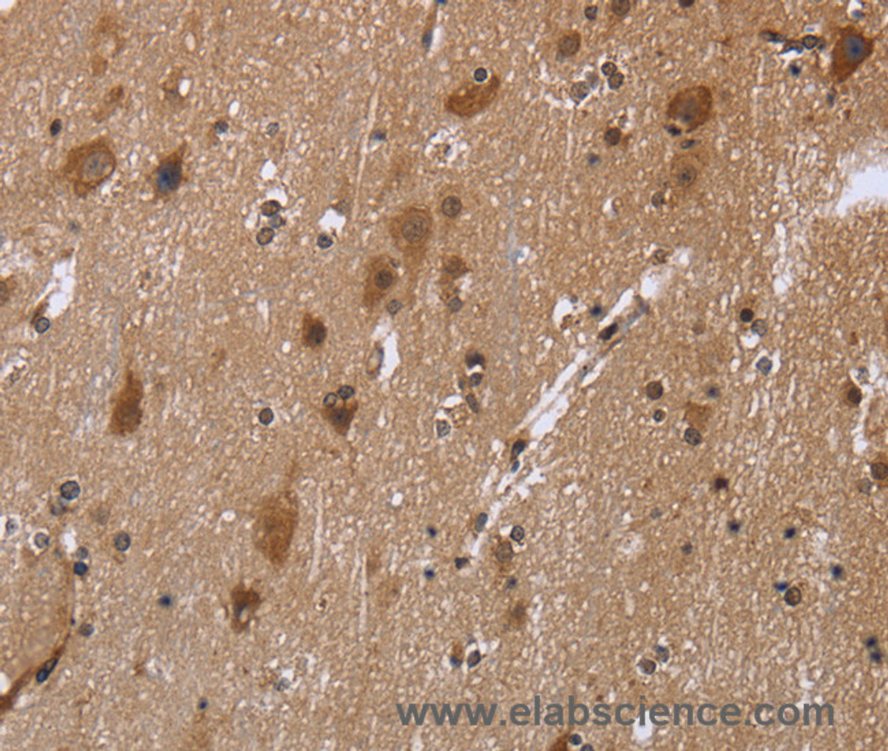 Immunohistochemistry of paraffin-embedded Human brain using c-Rel Polyclonal Antibody at dilution of 1:30