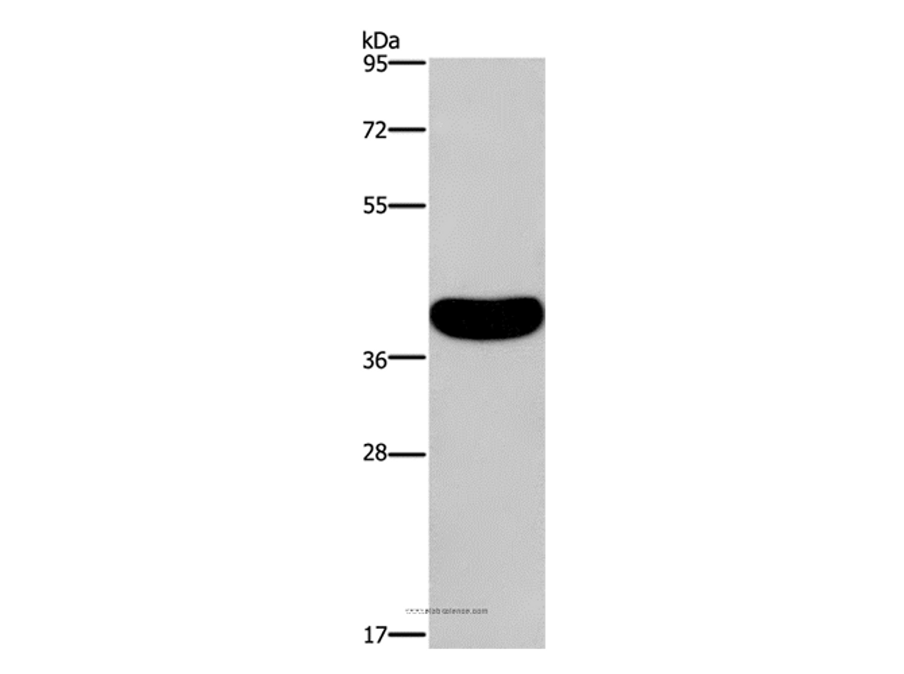 Western Blot analysis of Human normal colon tissue using CRELD2 Polyclonal Antibody at dilution of 1:550