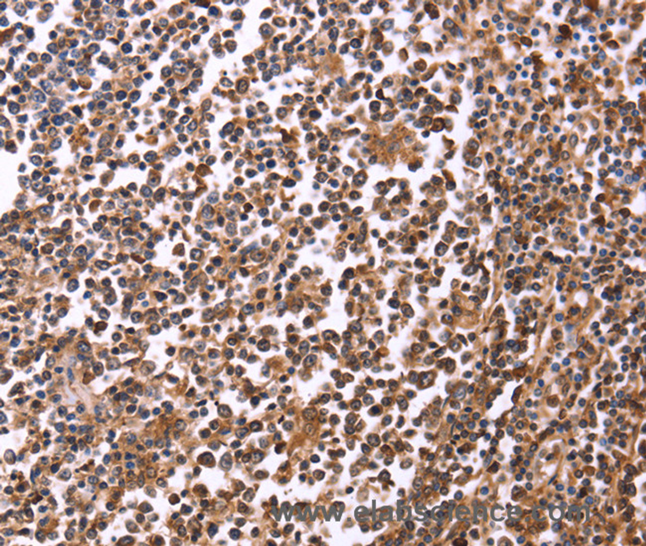 Immunohistochemistry of paraffin-embedded Human tonsil tissue using CRK Polyclonal Antibody at dilution 1:40