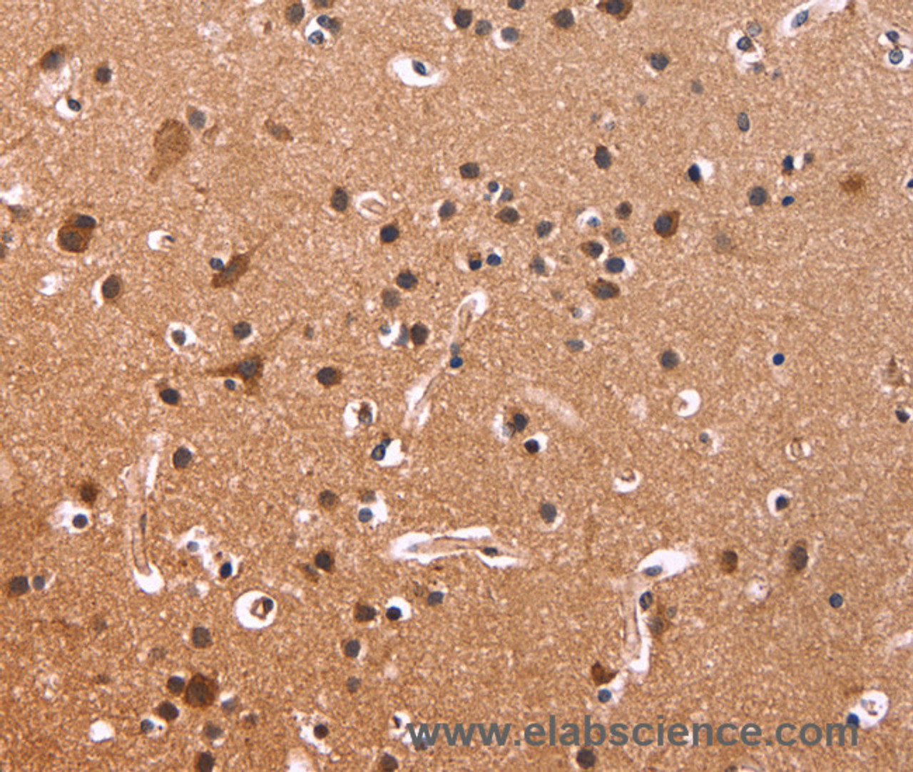 Immunohistochemistry of paraffin-embedded Human brain tissue using CSNK1D Polyclonal Antibody at dilution 1:50