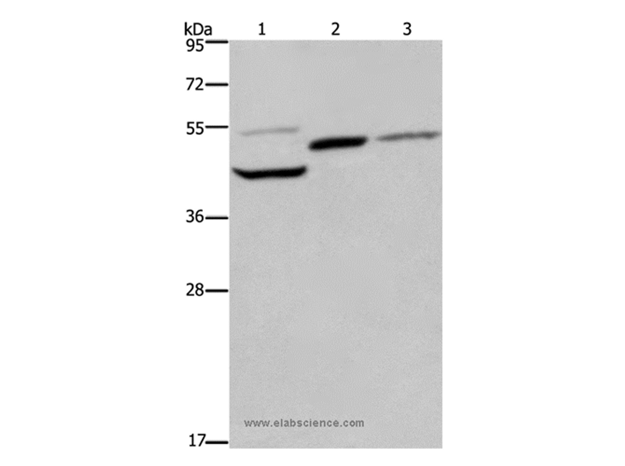 Western Blot analysis of Mouse heart, kidney and liver tissue using CYR61 Polyclonal Antibody at dilution of 1:350