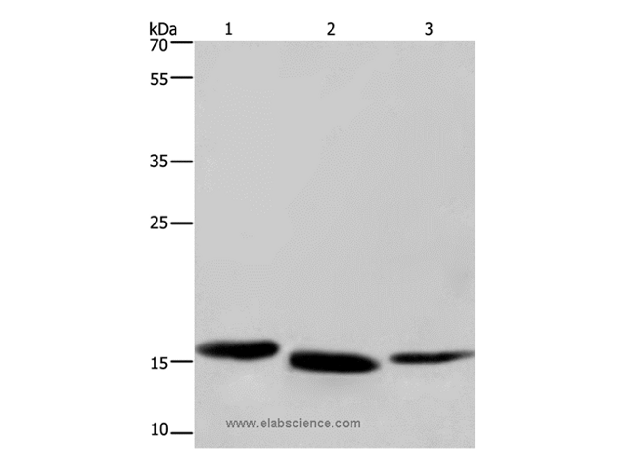 Western Blot analysis of Human kidney cancer, Mouse liver and Human bladder carcinoma tissue using Cytochrome b5 Polyclonal Antibody at dilution of 1:300