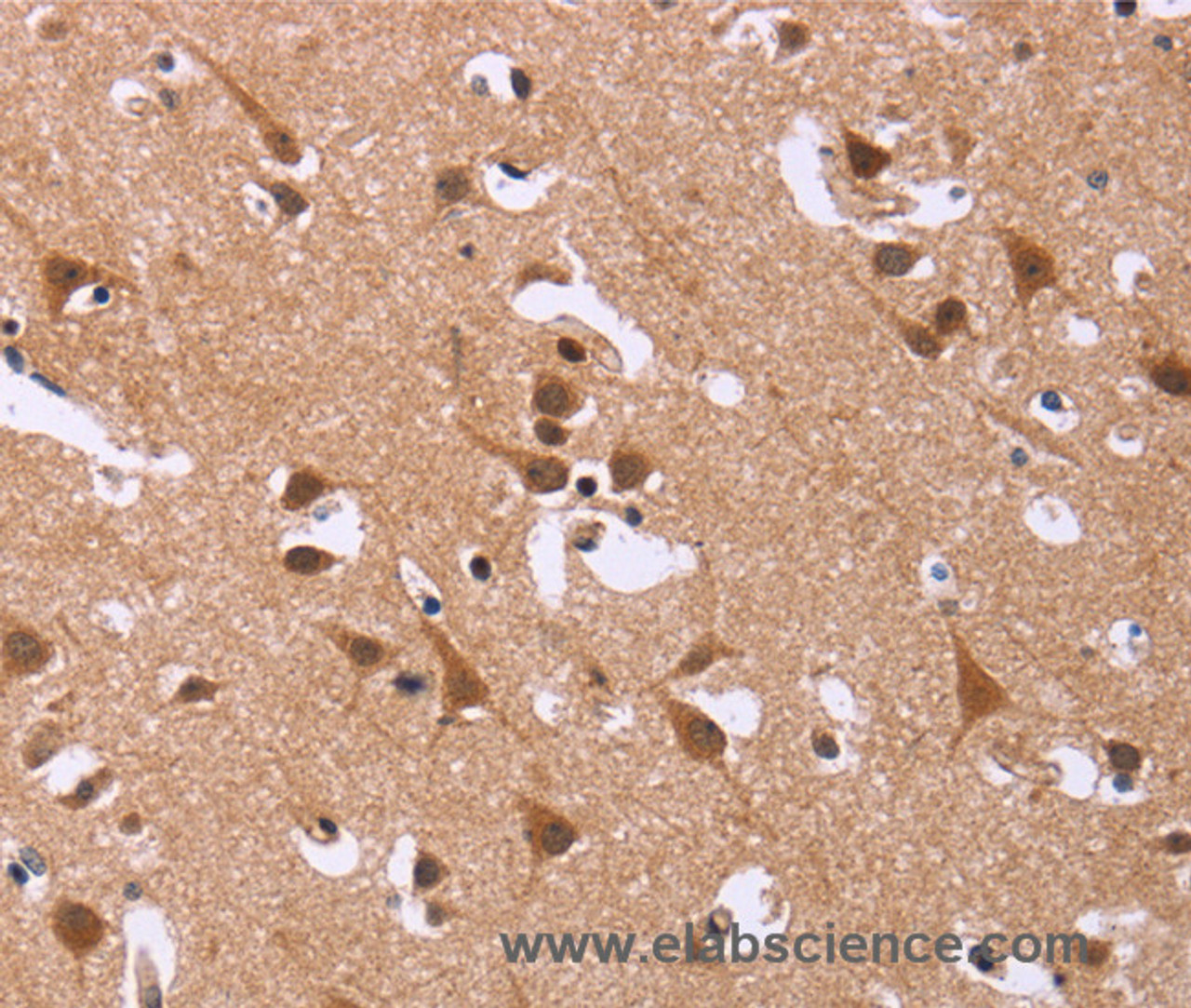Immunohistochemistry of paraffin-embedded Human brain  tissue using DCBLD2 Polyclonal Antibody at dilution 1:50